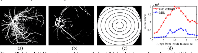 Figure 2 for Hierarchical method for cataract grading based on retinal images using improved Haar wavelet