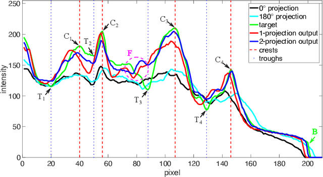 Figure 2 for Cephalogram Synthesis and Landmark Detection in Dental Cone-Beam CT Systems