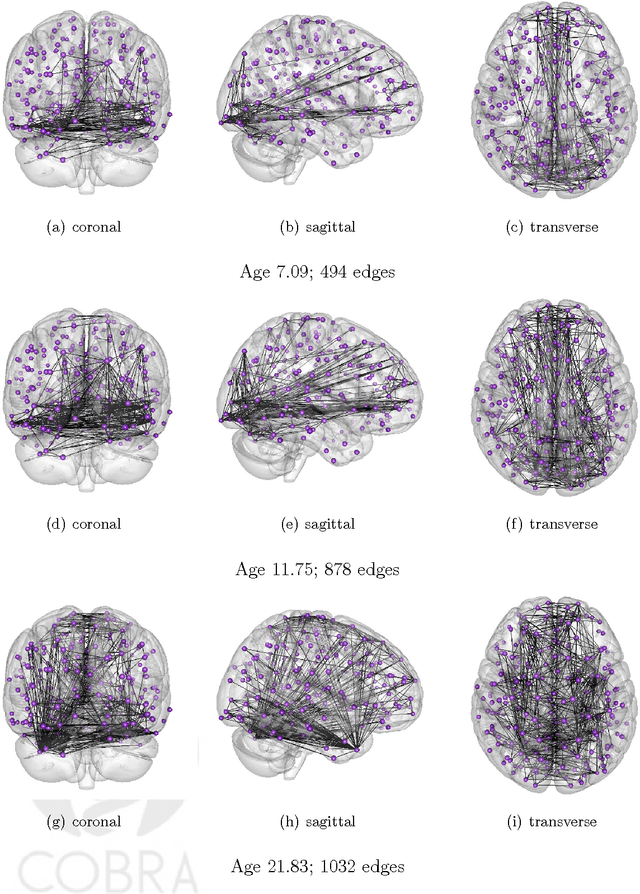 Figure 3 for Joint Estimation of Multiple Graphical Models from High Dimensional Time Series