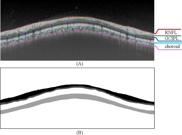Figure 2 for Dataset and Evaluation algorithm design for GOALS Challenge
