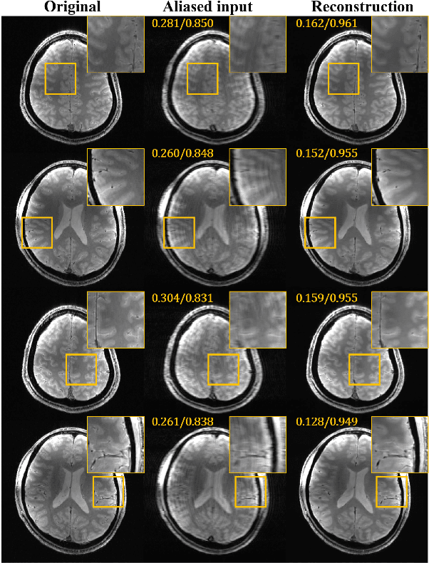 Figure 2 for Deep Residual Learning for Accelerated MRI using Magnitude and Phase Networks