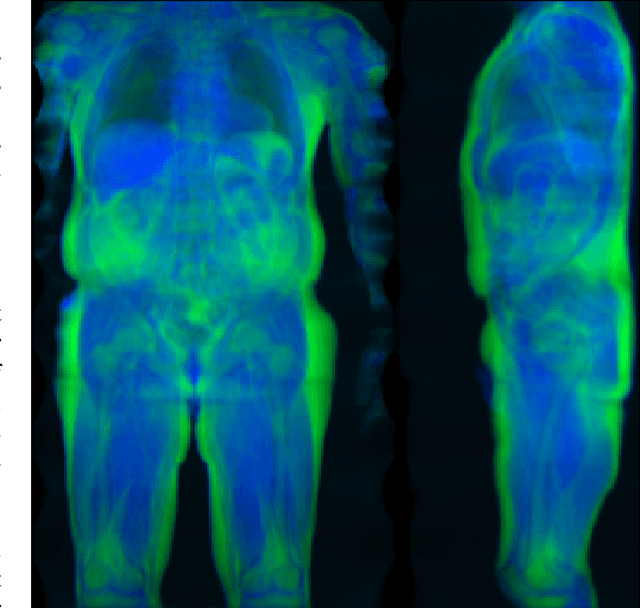 Figure 1 for Large-scale biometry with interpretable neural network regression on UK Biobank body MRI