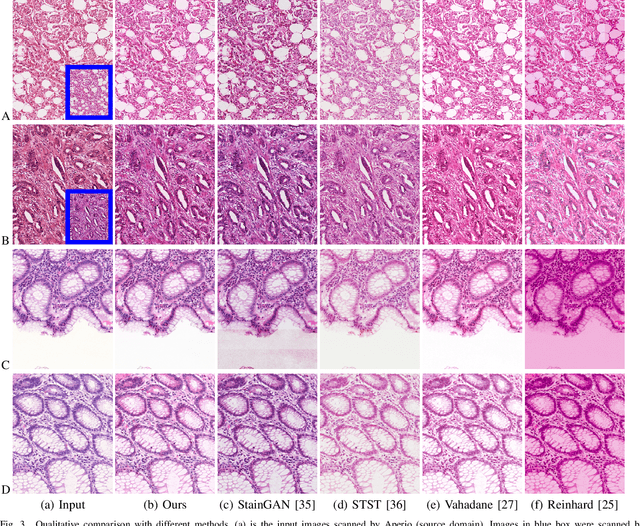 Figure 3 for RestainNet: a self-supervised digital re-stainer for stain normalization