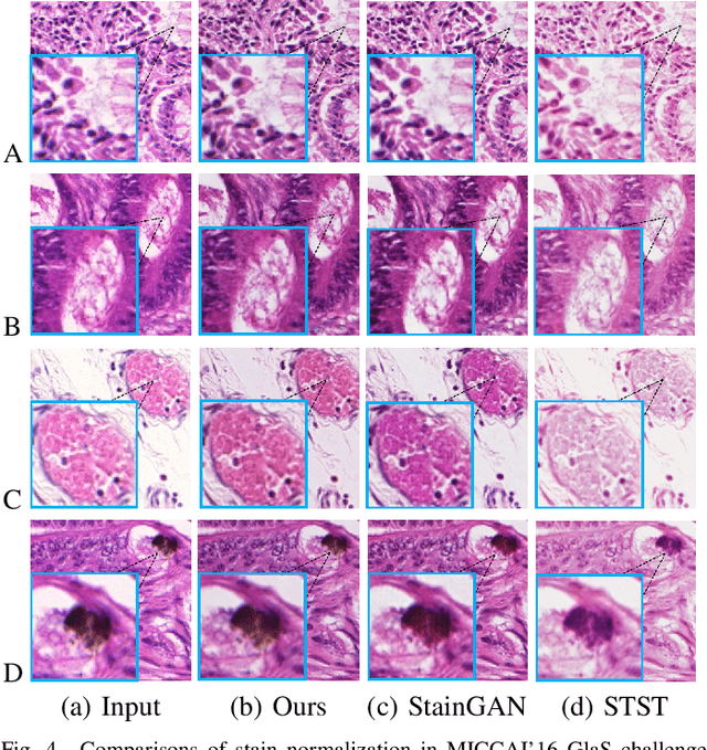 Figure 4 for RestainNet: a self-supervised digital re-stainer for stain normalization