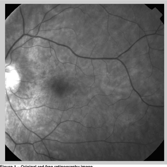 Figure 3 for BW - Eye Ophthalmologic decision support system based on clinical workflow and data mining techniques-image registration algorithm