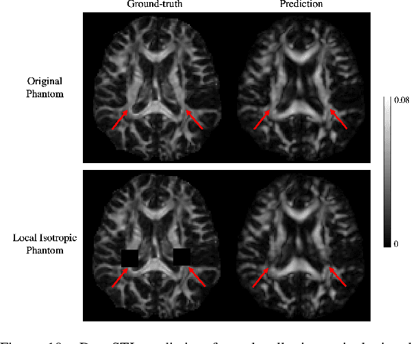 Figure 3 for DeepSTI: Towards Tensor Reconstruction using Fewer Orientations in Susceptibility Tensor Imaging