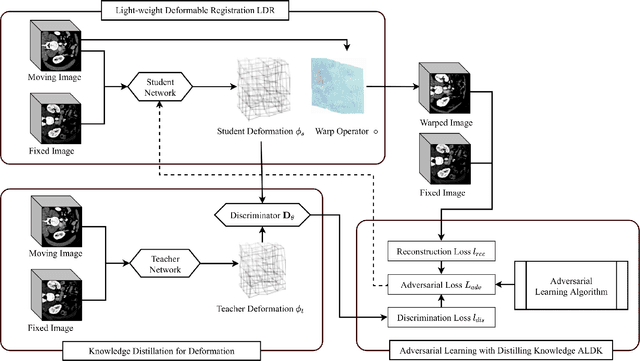 Figure 2 for Light-weight Deformable Registration using Adversarial Learning with Distilling Knowledge