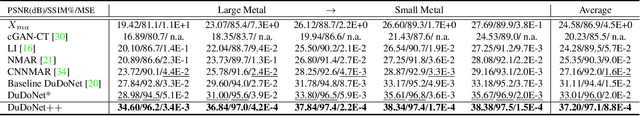 Figure 4 for DuDoNet++: Encoding mask projection to reduce CT metal artifacts