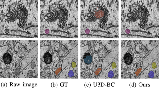 Figure 2 for Contrastive Learning for Mitochondria Segmentation