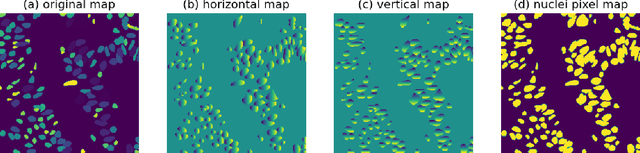 Figure 1 for ConvNeXt-backbone HoVerNet for nuclei segmentation and classification