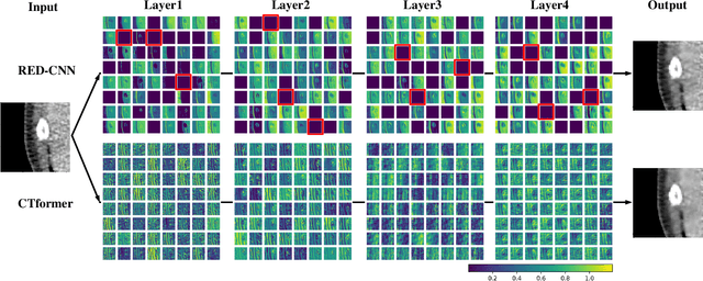 Figure 1 for CTformer: Convolution-free Token2Token Dilated Vision Transformer for Low-dose CT Denoising