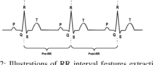 Figure 2 for Classification of ECG based on Hybrid Features using CNNs for Wearable Applications