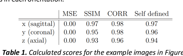 Figure 2 for Synthesis of realistic fetal MRI with conditional Generative Adversarial Networks