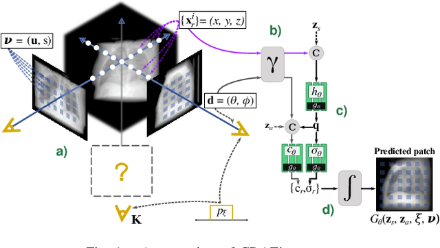 Figure 1 for MedNeRF: Medical Neural Radiance Fields for Reconstructing 3D-aware CT-Projections from a Single X-ray