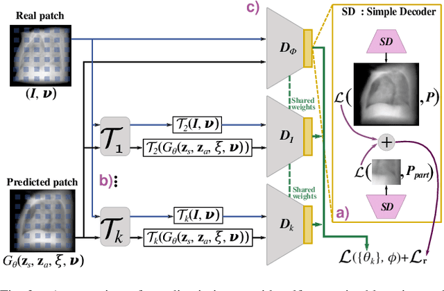 Figure 2 for MedNeRF: Medical Neural Radiance Fields for Reconstructing 3D-aware CT-Projections from a Single X-ray