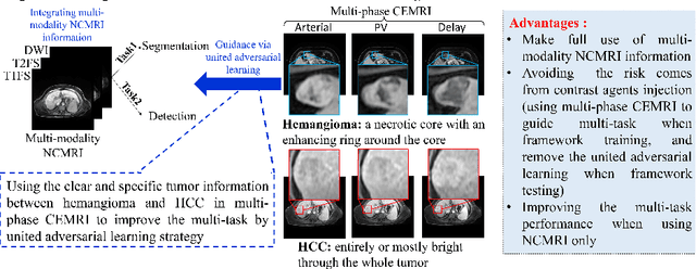 Figure 1 for United adversarial learning for liver tumor segmentation and detection of multi-modality non-contrast MRI