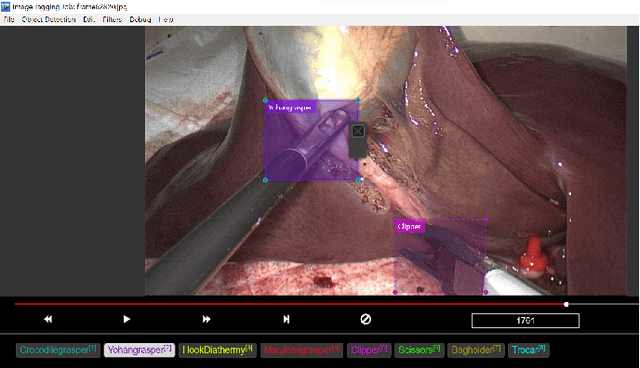 Figure 1 for Situation Awareness for Automated Surgical Check-listing in AI-Assisted Operating Room