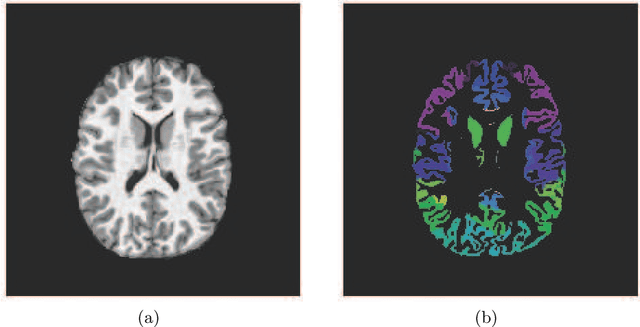 Figure 3 for A Combined Deep Learning-Gradient Boosting Machine Framework for Fluid Intelligence Prediction