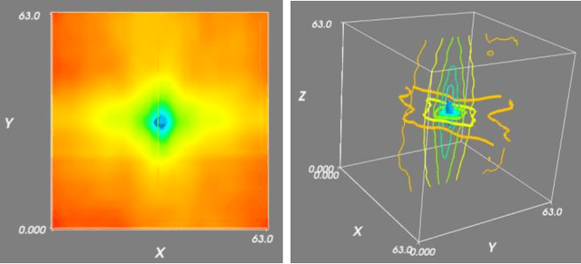 Figure 3 for Automatic 2D-3D Registration without Contrast Agent during Neurovascular Interventions