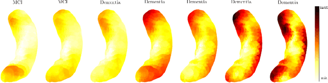 Figure 4 for TransforMesh: A Transformer Network for Longitudinal modeling of Anatomical Meshes