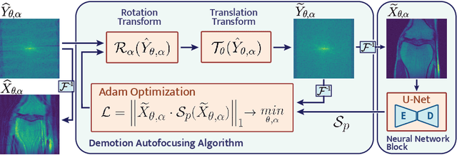Figure 1 for Autofocusing+: Noise-Resilient Motion Correction in Magnetic Resonance Imaging