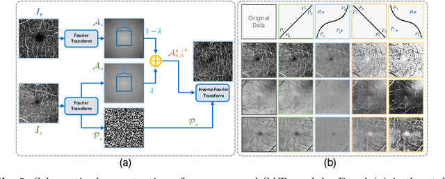 Figure 3 for Student Become Decathlon Master in Retinal Vessel Segmentation via Dual-teacher Multi-target Domain Adaptation