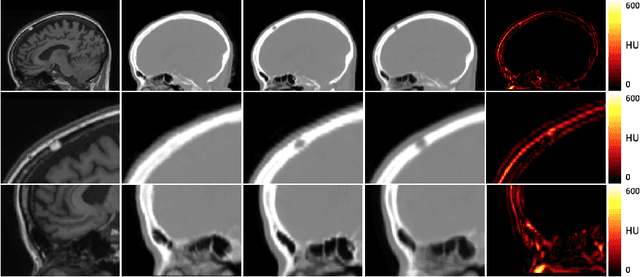 Figure 4 for Deep Boosted Regression for MR to CT Synthesis