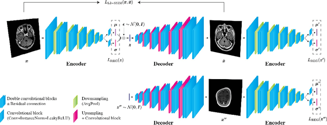 Figure 1 for Unsupervised Brain Abnormality Detection Using High Fidelity Image Reconstruction Networks