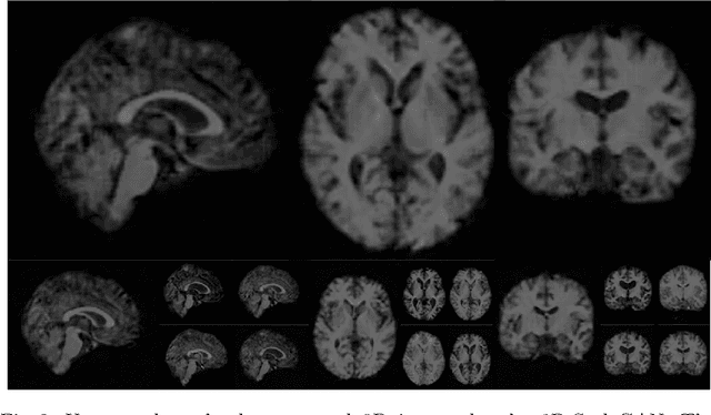 Figure 3 for 3D-StyleGAN: A Style-Based Generative Adversarial Network for Generative Modeling of Three-Dimensional Medical Images