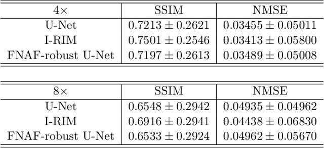 Figure 4 for Adversarial Robust Training in MRI Reconstruction