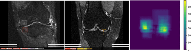 Figure 3 for Adversarial Robust Training in MRI Reconstruction