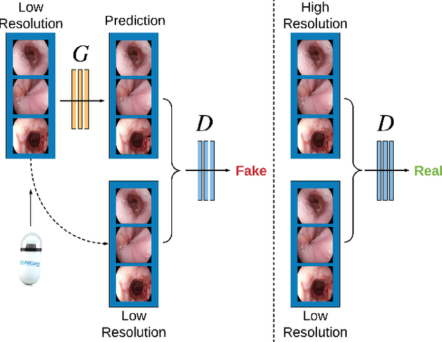 Figure 1 for EndoL2H: Deep Super-Resolution for Capsule Endoscopy