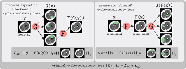 Figure 1 for An Asymetric Cycle-Consistency Loss for Dealing with Many-to-One Mappings in Image Translation: A Study on Thigh MR Scans