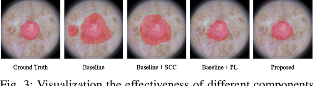 Figure 3 for PoissonSeg: Semi-Supervised Few-Shot Medical Image Segmentation via Poisson Learning