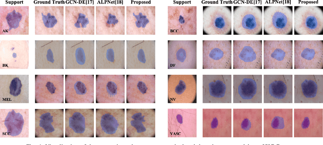 Figure 4 for PoissonSeg: Semi-Supervised Few-Shot Medical Image Segmentation via Poisson Learning