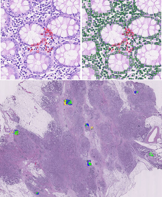 Figure 1 for Sparse-Shot Learning for Extremely Many Localisations