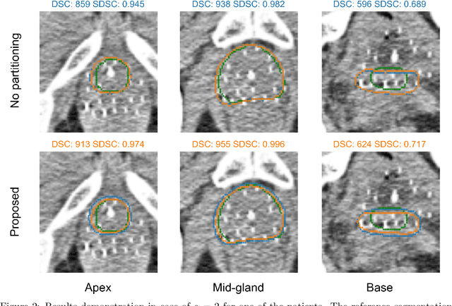 Figure 3 for Data variation-aware medical image segmentation