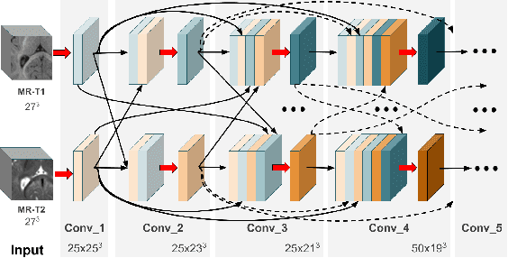 Figure 1 for HyperDense-Net: A hyper-densely connected CNN for multi-modal image segmentation