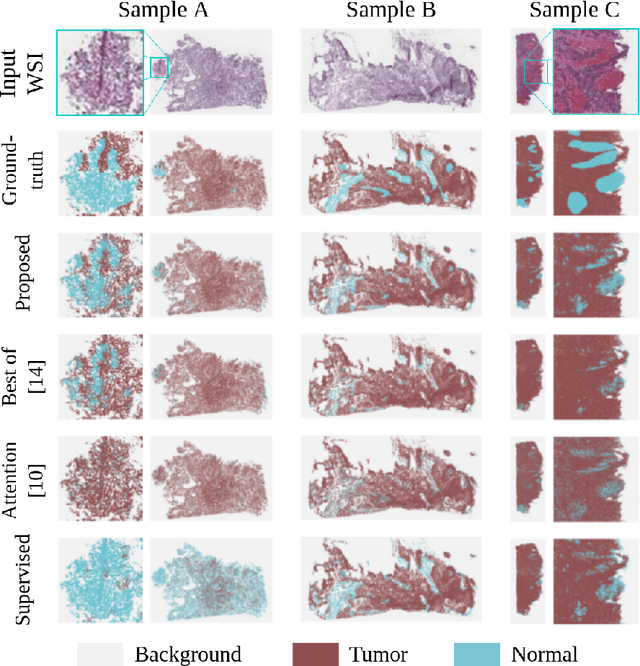 Figure 2 for Weakly supervised pan-cancer segmentation tool