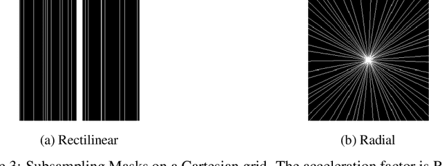 Figure 4 for Deep MRI Reconstruction with Radial Subsampling