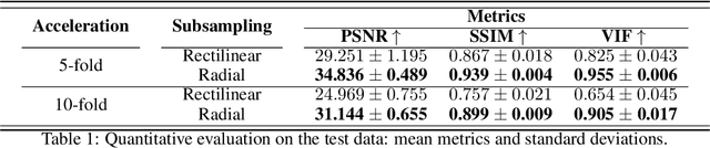 Figure 2 for Deep MRI Reconstruction with Radial Subsampling