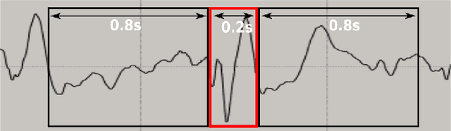 Figure 2 for Labeler-hot Detection of EEG Epileptic Transients