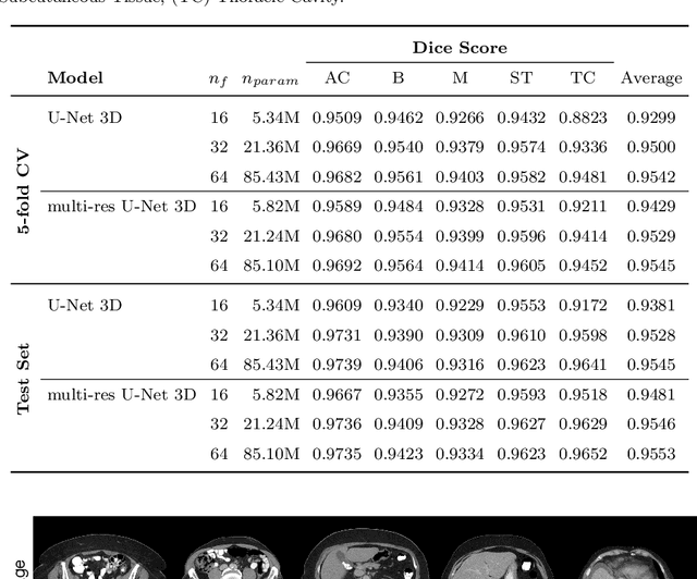 Figure 2 for Fully-automated Body Composition Analysis in Routine CT Imaging Using 3D Semantic Segmentation Convolutional Neural Networks