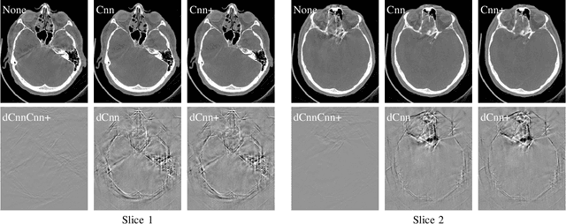 Figure 3 for Appearance Learning for Image-based Motion Estimation in Tomography