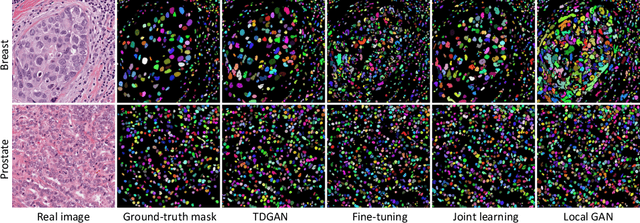 Figure 4 for Learn distributed GAN with Temporary Discriminators