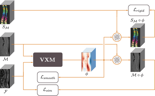 Figure 1 for Weakly-supervised Biomechanically-constrained CT/MRI Registration of the Spine