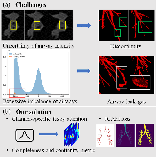 Figure 1 for Fuzzy Attention Neural Network to Tackle Discontinuity in Airway Segmentation