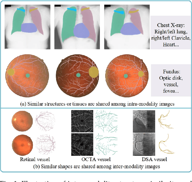 Figure 1 for Unsupervised Local Discrimination for Medical Images