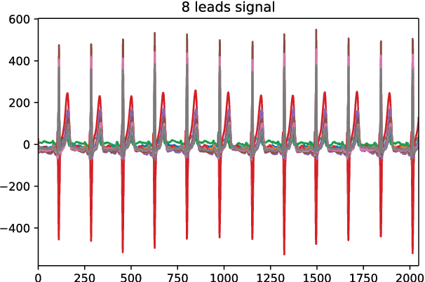 Figure 1 for SE-ECGNet: A Multi-scale Deep Residual Network with Squeeze-and-Excitation Module for ECG Signal Classification