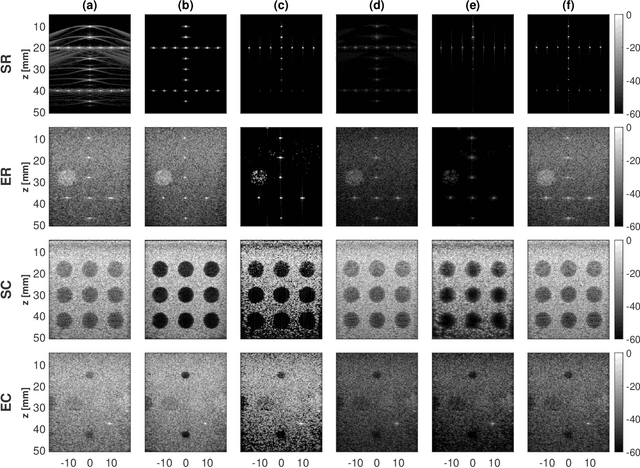 Figure 1 for A Unifying Approach to Ultrasound Beamforming and Deconvolution Using ADMM